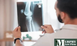 Montana Workers’ Comp Benefits for Broken Bones & Fractures